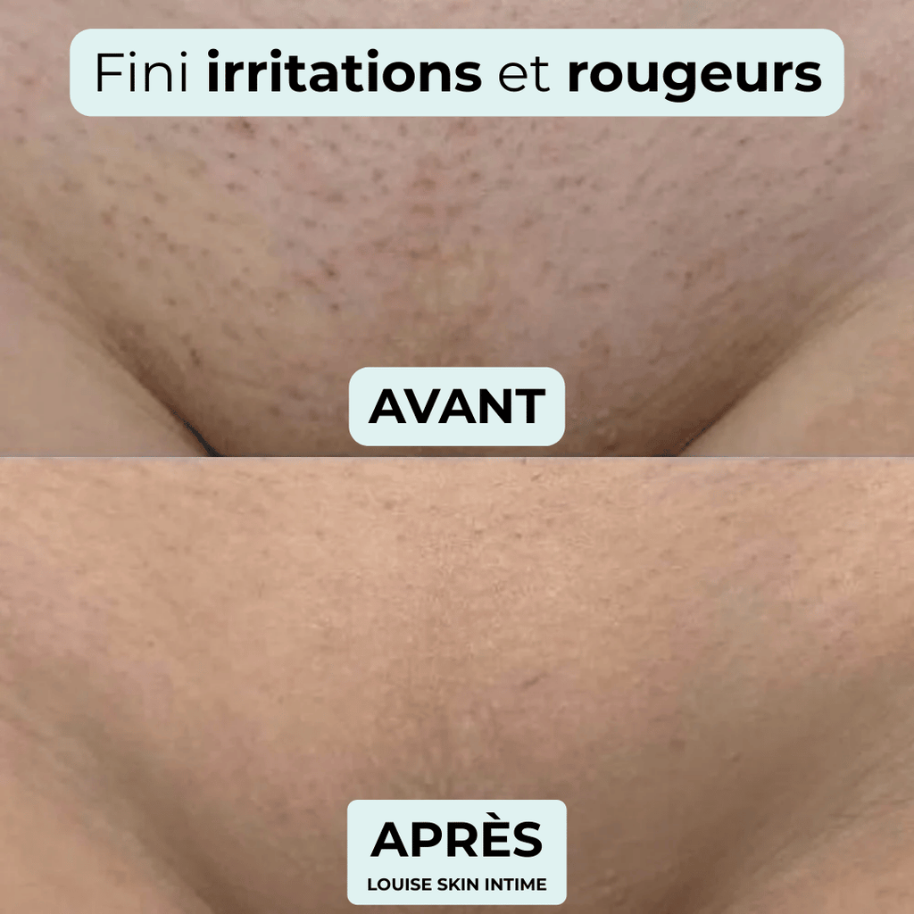 Rasoir intime - indolore et spécial peaux sensibles