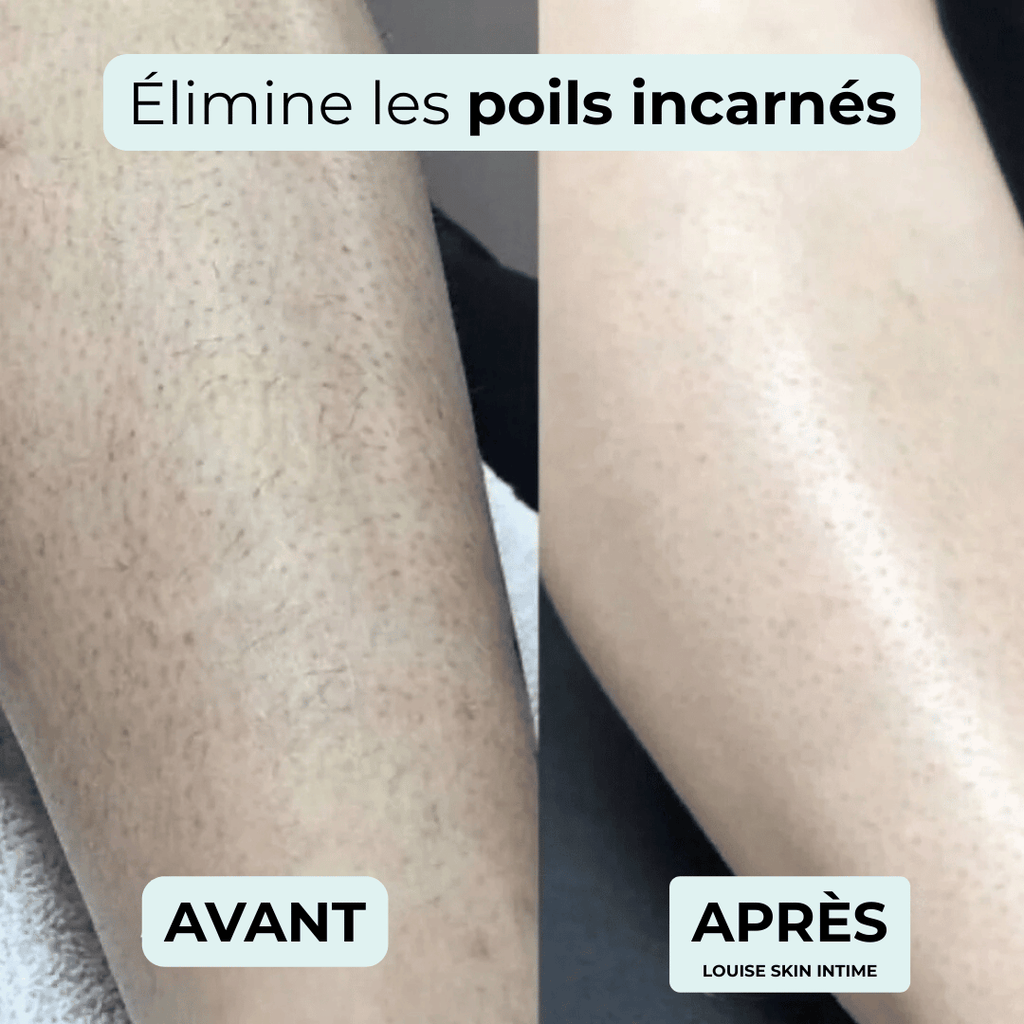 Rasoir intime - indolore et spécial peaux sensibles