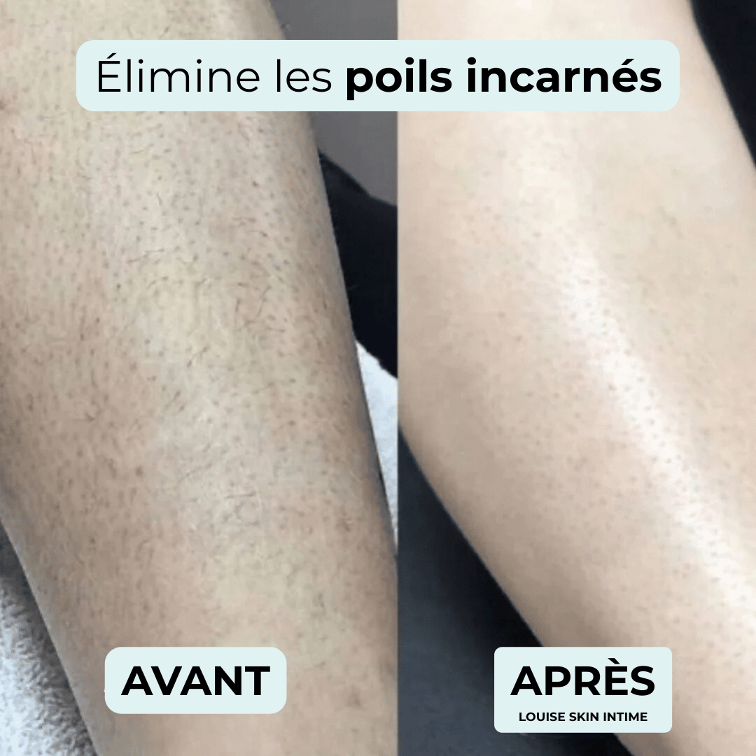 Rasoir intime - indolore et spécial peaux sensibles